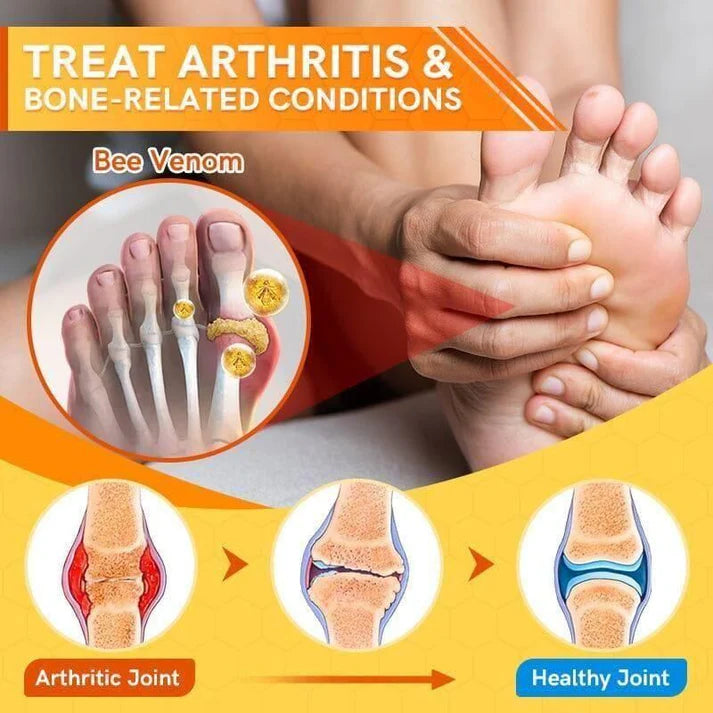 Bee Venom Joint and Bone Therapy Spray |⭐⭐⭐⭐⭐ (4.9/5)- Buy 1 Get 1 Free 🔥